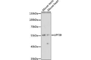 Western blot analysis of extracts of various cell lines, using UPF3B antibody (ABIN7271228) at 1:1000 dilution. (UPF3B antibody  (AA 1-180))