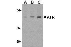 Image no. 2 for anti-anthrax Toxin Receptor 1 (ANTXR1) (Internal Region) antibody (ABIN205769)
