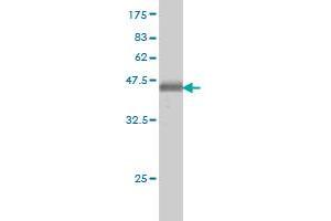 ATP2C1 antibody  (AA 119-269)