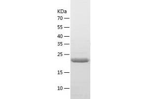 Western Blotting (WB) image for ABI Family, Member 3 (NESH) Binding Protein (ABI3BP) (AA 798-1045) protein (His tag) (ABIN7287777) (ABI3BP Protein (AA 798-1045) (His tag))