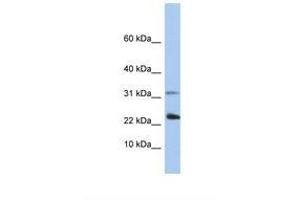 Image no. 1 for anti-Exosome Component 3 (EXOSC3) (C-Term) antibody (ABIN6737903) (EXOSC3 antibody  (C-Term))