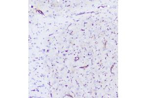 IHC analysis of INPPL1 using anti-INPPL1 antibody (ABIN6719492). (INPPL1 antibody  (AA 1172-1258))