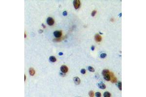 Immunohistochemical analysis of PIAS4 staining in human brain formalin fixed paraffin embedded tissue section. (PIAS4 antibody  (C-Term))