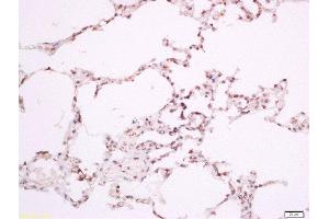 Paraformaldehyde-fixed, paraffin embedded rat lung, Antigen retrieval by boiling in sodium citrate buffer (pH6) for 15min, Block endogenous peroxidase by 3% hydrogen peroxide for 30 minutes, Blocking buffer (normal goat serum) at 37°C for 20min, Antibody incubation with Rabbit Anti-ILK-1(Thr173) Polyclonal Antibody, Unconjugated  at 1:200 overnight at 4°C, followed by a conjugated secondary for 90 minutes and DAB staining. (ILK antibody  (pThr173))