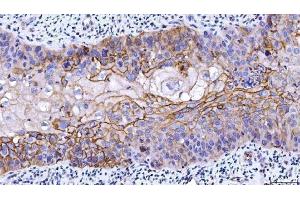 IHC analysis of CD55 using anti-CD55 antibody (ABIN7601422).