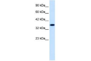WB Suggested Anti-ZNF75 Antibody Titration:  1. (ZNF75 antibody  (Middle Region))