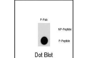 Dot blot analysis of Phospho-AKT2- polyclonal antibody (ABIN389734 and ABIN2839673) on nitrocellulose membrane.