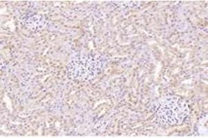 Immunohistochemistry analysis of paraffin-embedded rat kidney using,CTSV (ABIN7073348) at dilution of 1: 2000 (Cathepsin L2 antibody)