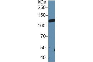 Western Blotting (WB) image for anti-Leukemia Inhibitory Factor Receptor alpha (LIFR) (AA 152-291) antibody (ABIN7432040)