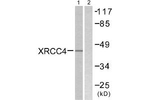 Western blot analysis of extracts from COLO205 cells, using XRCC4 antibody. (XRCC4 antibody  (C-Term))