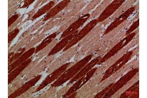 Immunohistochemical analysis of paraffin-embedded Human-skeletal-muscle, antibody was diluted at 1:100 (MYH6/MYH7 (AA 1871-1920) antibody)