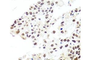 Immunohistochemistry (Paraffin-embedded Sections) (IHC (p)) image for anti-HIR Histone Cell Cycle Regulation Defective Homolog A (HIRA) antibody (ABIN7264499)