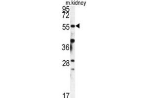 Western Blotting (WB) image for anti-FK506 Binding Protein 9, 63 KDa (FKBP9) antibody (ABIN3003182)