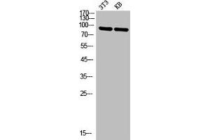 Western Blot analysis of NIH-3T3 KB cells using P-Selectin Polyclonal Antibody (P-Selectin antibody  (N-Term))