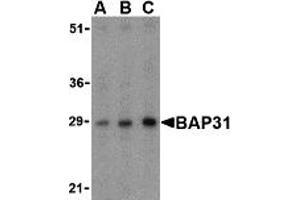 Western Blotting (WB) image for anti-B-Cell Receptor-Associated Protein 31 (BCAP31) (Middle Region) antibody (ABIN1030882) (BCAP31 antibody  (Middle Region))
