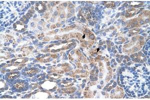 Human kidney (SLC29A2 antibody  (N-Term))