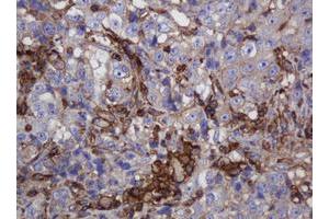 Image no. 7 for anti-Fibronectin Type III Domain Containing 4 (FNDC4) antibody (ABIN1498289)