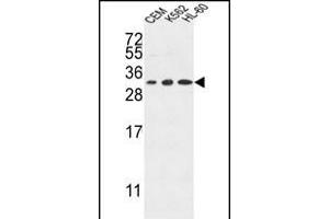 TSN2 Antibody (Center) (ABIN653269 and ABIN2842786) western blot analysis in CEM,K562,HL-60 cell line lysates (35 μg/lane). (Tetraspanin 2 antibody  (AA 109-137))