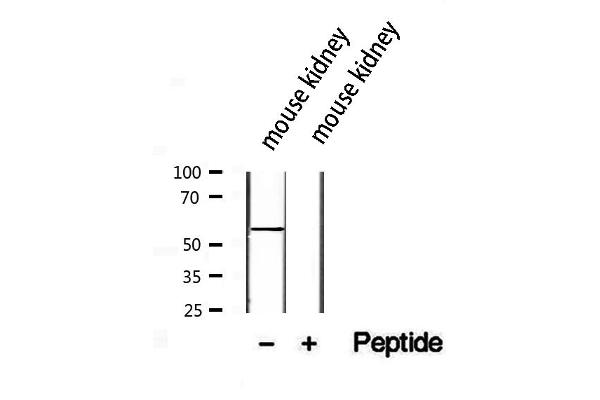 SLC13A2 antibody