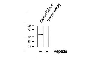 Western blot analysis of extracts from mouse kidney, using SLC13A2 antibody.