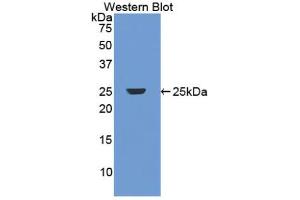 Western blot analysis of recombinant Human DBP.