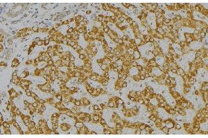 ABIN6276571 at 1/100 staining Mouse liver tissue by IHC-P. (GAS2 antibody  (C-Term))