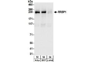 anti-Ribosome Binding Protein 1 (RRBP1) (AA 1425-1472) antibody