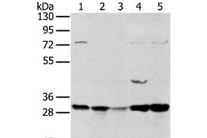 Western Blot analysis of 293T and MCF7 cell, Mouse brain tissue and K562 cell, Mouse bladder tissue using TPD54 Polyclonal Antibody at dilution of 1:400 (TPD52L2 antibody)