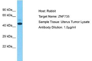 Host: Rabbit Target Name: ZNF735 Sample Type: Uterus Tumor lysates Antibody Dilution: 1. (Zinc Finger Protein 735 (ZNF735) (Middle Region) antibody)