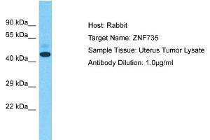 Zinc Finger Protein 735 (ZNF735) (Middle Region) antibody