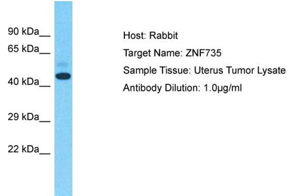 Zinc Finger Protein 735 (ZNF735) (Middle Region) antibody