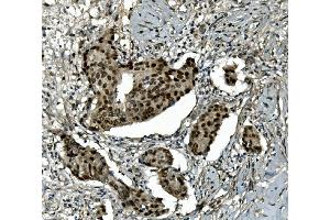 IHC analysis of Transketolase/TKT using anti-Transketolase/TKT antibody (ABIN7598959). (TKT antibody  (AA 1-116))