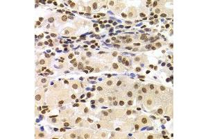 Immunohistochemistry of paraffin-embedded human stomach using HMGB1 Antibody. (HMGB1 antibody  (AA 100-200))