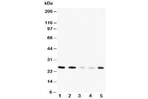 Western blot testing of Pleiotrophin antibody and Lane 1:  rat brain (Pleiotrophin antibody  (C-Term))