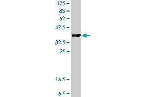 Western Blot detection against Immunogen (37. (ST3GAL4 antibody  (AA 31-130))