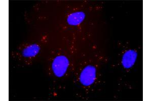 Proximity Ligation Analysis of protein-protein interactions between BID and BAX. (BID antibody  (AA 1-195))