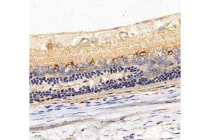 Immunohistochemistry of paraffin embedded rat eye using C1QL2 (ABIN7073561) at dilution of 1: 1000 (400x lens)