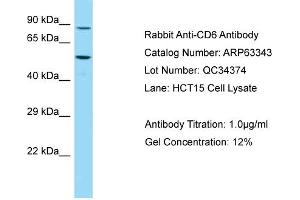 Western Blotting (WB) image for anti-CD6 (CD6) (C-Term) antibody (ABIN2789458) (CD6 antibody  (C-Term))