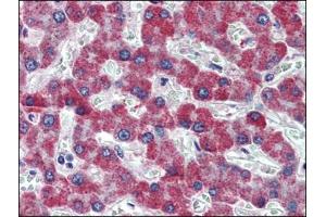 Human Liver: Formalin-Fixed, Paraffin-Embedded (FFPE) (PAR1 antibody  (Internal Region))