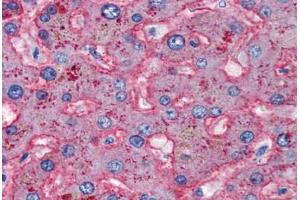 Human Liver (formalin-fixed, paraffin-embedded) stained with APOB antibody ABIN337314 at 5 ug/ml followed by biotinylated anti-goat IgG secondary antibody ABIN481715, alkaline phosphatase-streptavidin and chromogen. (APOB antibody)