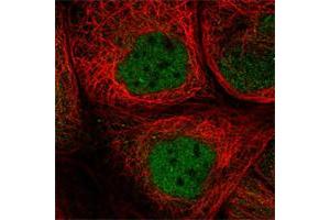 Immunofluorescent staining of human cell line A-431 shows positivity in nucleus but not nucleoli. (SMCR8 antibody)