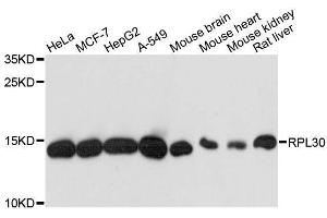 Western blot analysis of extracts of various cell lines, using RPL30 antibody.