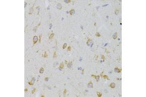 Immunohistochemistry of paraffin-embedded mouse brain using KISS1R Antibody (ABIN3017091, ABIN3017092, ABIN3017093 and ABIN6219946) at dilution of 1:100 (40x lens). (KISS1R antibody)