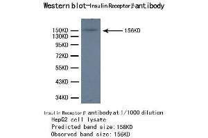 Western Blotting (WB) image for anti-Insulin Receptor beta (ISR-beta) antibody (ABIN1873245)