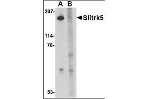 Western blot analysis of Slitrk5 in 3T3 cell lysate with this product at 1 μg/ml in the (A) absence or (B) presence of blocking peptide. (SLITRK5 antibody  (Center))