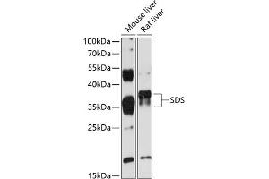 Western blot analysis of extracts of various cell lines, using SDS antibody (ABIN6132920, ABIN6147476, ABIN6147477 and ABIN6216699) at 1:3000 dilution. (serine Dehydratase antibody  (AA 90-170))