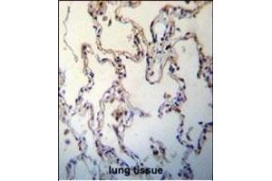 RAGE(AGER) Antibody (C-term) (ABIN389028 and ABIN2839245) immunohistochemistry analysis in formalin fixed and paraffin embedded human lung tissue followed by peroxidase conjugation of the secondary antibody and DAB staining. (RAGE antibody  (C-Term))