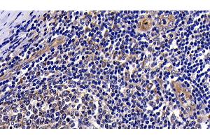 Detection of PKBa in Human Amygdalitis Tissue using Polyclonal Antibody to Protein Kinase B Alpha (PKBa) (AKT1 antibody  (AA 122-443))