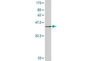 Western Blot detection against Immunogen (36. (SEC24D antibody  (AA 935-1032))
