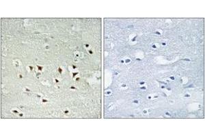 Immunohistochemistry analysis of paraffin-embedded human brain, using MAPKAPK2 (Phospho-Thr334) Antibody. (MAPKAP Kinase 2 antibody  (pThr334))